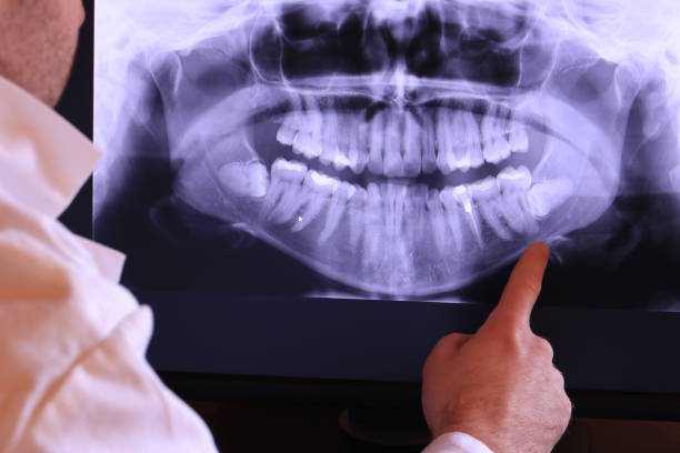 Best Broken Tooth Emergency  in Fruitport, MI